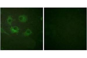 Immunofluorescence analysis of HuvEc cells, using Claudin 3 Antibody. (Claudin 3 anticorps  (AA 171-220))