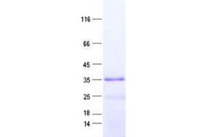 Validation with Western Blot