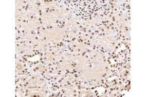 ABIN6267406 at 1/200 staining human kidney tissue sections by IHC-P. (Stathmin 1 anticorps  (pSer38))