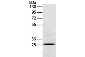 Western Blot analysis of Mouse brain tissue using TREM2 Polyclonal Antibody at dilution of 1:250 (TREM2 anticorps)