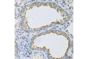 Immunohistochemistry of paraffin-embedded mouse lung using AP2B1 Antibody (ABIN1871002) at dilution of 1:100 (40x lens).