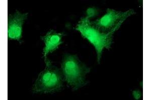 Immunofluorescence (IF) image for anti-Cyclin-Dependent Kinase 2 (CDK2) antibody (ABIN1497400) (CDK2 anticorps)