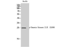 Western Blotting (WB) image for anti-Casein Kinase 2, beta (CSNK2B) (pSer209) antibody (ABIN3173273) (CSNK2B anticorps  (pSer209))