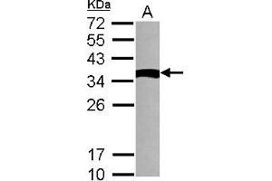 Western Blotting (WB) image for anti-NME Gene Family Member 9 (NME9) (AA 1-142) antibody (ABIN1501588)