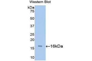 Western Blotting (WB) image for anti-Synuclein, alpha (SNCA) (AA 1-140) antibody (ABIN1715843) (SNCA anticorps  (AA 1-140))