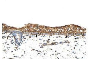 RBPMS antibody was used for immunohistochemistry at a concentration of 4-8 ug/ml to stain Squamous epithelial cells (arrows) in Human Skin.