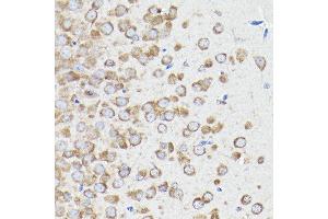 Immunohistochemistry of paraffin-embedded mouse brain using eEF1 Rabbit pAb (7857) at dilution of 1:100 (40x lens).