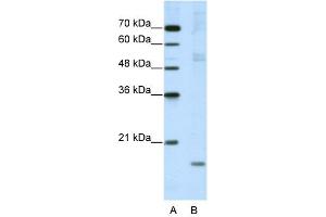 WB Suggested Anti-NIP7 Antibody Titration:  5. (NIP7 anticorps  (C-Term))