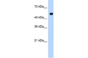 WB Suggested Anti-PUF60 Antibody  Titration: 1. (PUF60 anticorps  (C-Term))