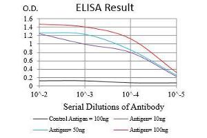 Black line: Control Antigen (100 ng), Purple line: Antigen(10 ng), Blue line: Antigen (50 ng), Red line: Antigen (100 ng), (SYCP3 anticorps  (AA 27-128))