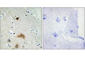 Immunohistochemistry analysis of paraffin-embedded human brain tissue, using LASS4 Antibody. (LASS4 anticorps  (AA 41-90))