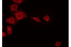 ABIN6275660 staining Hela by IF/ICC. (UBFD1 anticorps  (Internal Region))