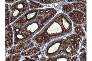 Image no. 5 for anti-Pogo Transposable Element with KRAB Domain (POGK) antibody (ABIN1500328)