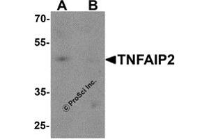 Western Blotting (WB) image for anti-Tumor Necrosis Factor, alpha-Induced Protein 2 (TNFAIP2) antibody (ABIN1077380) (TNFAIP2 anticorps)