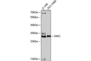 Western blot analysis of extracts of various cell lines, using DKK2 antibody (ABIN7266756) at 1:1000 dilution.