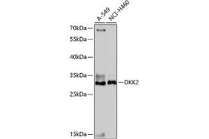 Western blot analysis of extracts of various cell lines, using DKK2 antibody (ABIN7266756) at 1:1000 dilution. (DKK2 anticorps  (C-Term))