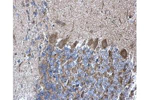 IHC-P Image RPL5 antibody detects RPL5 protein at cytoplasm on mouse hind brain by immunohistochemical analysis. (RPL5 anticorps)
