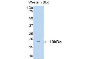 Western Blotting (WB) image for anti-Gonadotropin-Releasing Hormone 1 (Luteinizing-Releasing Hormone) (GNRH1) (AA 22-140) antibody (FITC) (ABIN1859037) (GNRH1 anticorps  (AA 22-140) (FITC))
