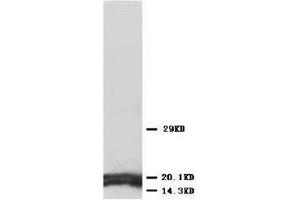 Western blot analysis of rat tissue sections (kidney) lysis using AQP1 antibody (Aquaporin 1 anticorps  (C-Term))