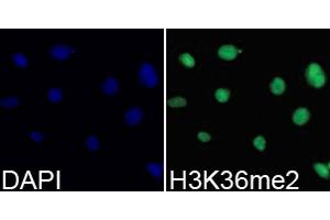 Immunofluorescence analysis of 293T cell using H3K36me2 antibody.
