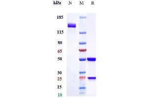 Anti-SOST / Sclerostin Reference Antibody (romosozumab) on SDS-PAGE under reducing (R) condition.