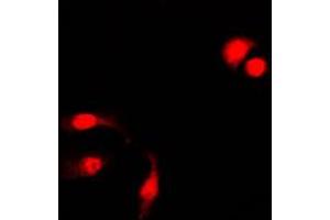Immunofluorescent analysis of NF-kappaB p105 (pS927) staining in HeLa cells. (NFKB1 anticorps  (C-Term, pSer927))