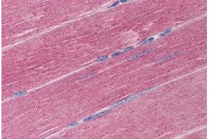 Human Skeletal Muscle (formalin-fixed, paraffin-embedded) stained with ADAM17 antibody ABIN290260 at 20 ug/ml followed by biotinylated goat anti-rabbit IgG secondary antibody ABIN481713, alkaline phosphatase-streptavidin and chromogen. (ADAM17 anticorps  (C-Term))