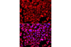 Immunofluorescence analysis of A549 cells using NDUFV1 antibody (ABIN5974962). (NDUFV1 anticorps)