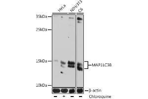 Western blot analysis of extracts of various cell lines, using MLC3B antibody (ABIN7268520) at 1:1000 dilution.