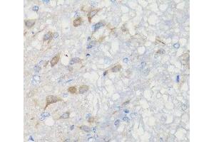 Immunohistochemistry of paraffin-embedded Rat brain using CHIC2 Polyclonal Antibody at dilution of 1:100 (40x lens). (CHIC2 anticorps)