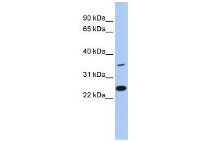 WB Suggested Anti-LYVE1 Antibody Titration: 0. (LYVE1 anticorps  (N-Term))