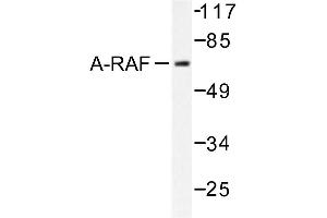 Image no. 1 for anti-V-Raf Murine Sarcoma 3611 Viral Oncogene Homolog (ARAF) antibody (ABIN271994) (ARAF anticorps)