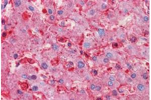 Human Liver: Formalin-Fixed, Paraffin-Embedded (FFPE)