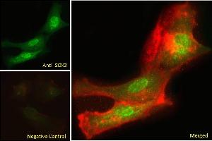 ABIN6391384 Immunofluorescence analysis of paraformaldehyde fixed U251 cells, permeabilized with 0.