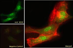 ABIN6391384 Immunofluorescence analysis of paraformaldehyde fixed U251 cells, permeabilized with 0. (SOX2 anticorps  (N-Term))