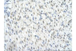 Rabbit Anti-CTNNB1 Antibody     AV  Paraffin Embedded Tissue:  Human cardiac cell   Cellular Data:  Epithelial cells of renal tubule  Antibody Concentration:   4.