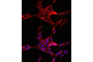 Immunofluorescence analysis of PC-12 cells using TXNIP antibody (ABIN6130776, ABIN6149733, ABIN6149734 and ABIN6224986) at dilution of 1:100.