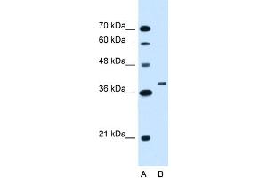 WB Suggested Anti-RNF146 Antibody Titration:  1. (RNF146 anticorps  (C-Term))