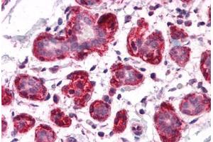Human Breast: Formalin-Fixed, Paraffin-Embedded (FFPE) (SH3BP4 anticorps  (C-Term))