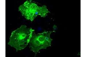 Image no. 4 for anti-Fc gamma RII (CD32) antibody (ABIN1497254) (Fc gamma RII (CD32) anticorps)