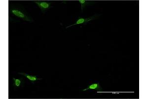 Immunofluorescence of monoclonal antibody to PBK on HeLa cell.