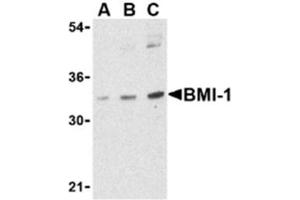Image no. 1 for anti-BMI1 Polycomb Ring Finger Oncogene (BMI1) (Middle Region) antibody (ABIN318769) (BMI1 anticorps  (Middle Region))