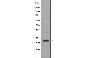 Western blot analysis of extracts from HeLa using CRP1 antibody.