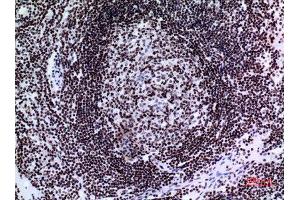 Immunohistochemistry (IHC) analysis of paraffin-embedded Human Lymph Gland, antibody was diluted at 1:100.