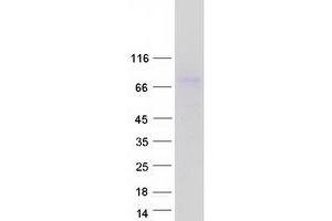 Validation with Western Blot