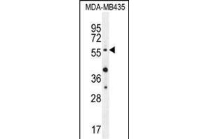 AKT1 (Thr308) Antibody (ABIN654500 and ABIN2844231) western blot analysis in MDA-M cell line lysates (35 μg/lane). (AKT1 anticorps  (Thr308))