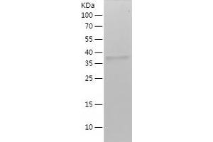 Western Blotting (WB) image for Keratin 15 (KRT15) (AA 350-456) protein (His-IF2DI Tag) (ABIN7123673)