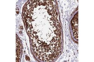 Immunohistochemical staining of human testis with LSM7 polyclonal antibody  shows strong cytoplasmic positivity in cells in seminiferus duct. (LSM7 anticorps)