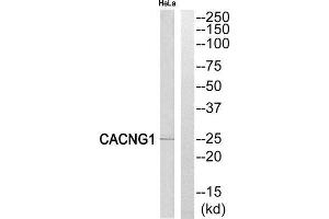 Western Blotting (WB) image for anti-Calcium Channel, Voltage-Dependent, gamma Subunit 1 (CACNG1) (Internal Region) antibody (ABIN1852386) (CACNG1 anticorps  (Internal Region))