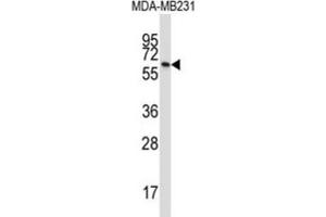 Western Blotting (WB) image for anti-Butyrophilin, Subfamily 3, Member A1 (BTN3A1) antibody (ABIN2997361) (BTN3A1 anticorps)